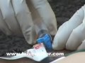 DROGADICTO SALVADO DE MORIR EN EL ULTIMO MOMENTO