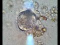 Balantidium Coli in Otter Balantidium Coli in Otter
