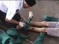 SJAM Perak: State First Aid & Home Nursing Competition