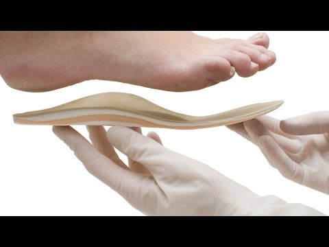 how to cure flat feet