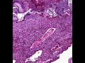 Shotgun Histology Placenta