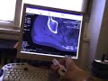 Wii remote : reporting a CT scan (GlovePIE)