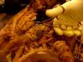 Anatomia - mediastino 30/05 UCSUR A