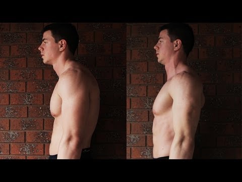 how to improve posture