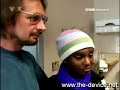 Botfly larvae extracted from neck of child