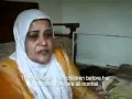 Fallujah babies born with birth defects as a result of Depleted Uranium WMD contaminated dust.