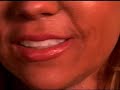 Think Tan is Beautiful? Skin Cancer PSA Think Tan is Beautiful? Skin Cancer PSA