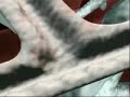 What is Asthma ?  Animation