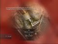 Spawn In a Confined Space.