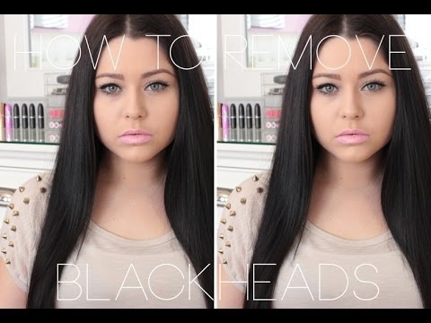 how to remove whiteheads