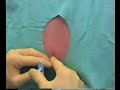 S.O. Klinik - Epidural Anestezi