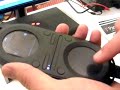 Tonio's pacemaker gets the hands-on treatment.