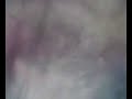 Thumbnail #3