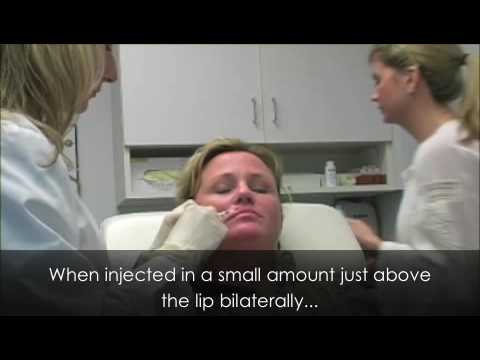 See video