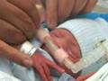 CPAP-Continuous-Posi