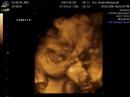 Ignacio: 28th week 4D Ultrasound