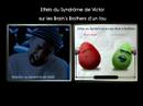 La Saga des Brain\