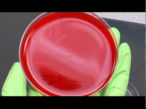 how to isolate streptococcus pyogenes