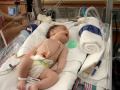 *Harleigh a CDH Miracle*