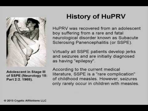Epilepsy and HuPRV