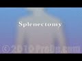 PreOp® Patient Education Spleen Removal Laparoscopic Splenectomy 2