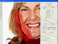 Facial Rejuvenation Facial Rejuvenation