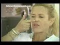 Venezolana desfigurada en Cuba
