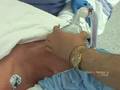 Part 4   Anesthesia   Actual Medical Procedure