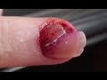 I RIPPED UP MY NAIL!!!
