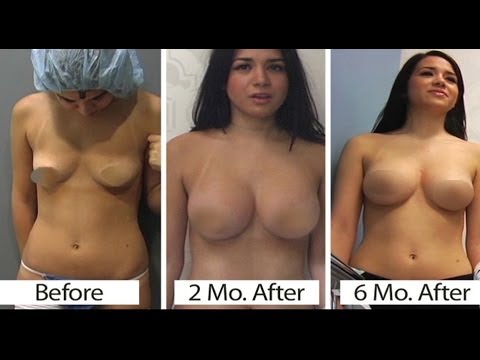 See video