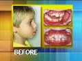 Better Faces Easier Orthodontics Better Faces Easier Orthodontics