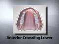 Better Faces Easier Orthodontics
