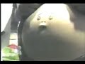 ombligo chiflador