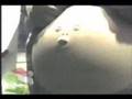 ombligo chiflador