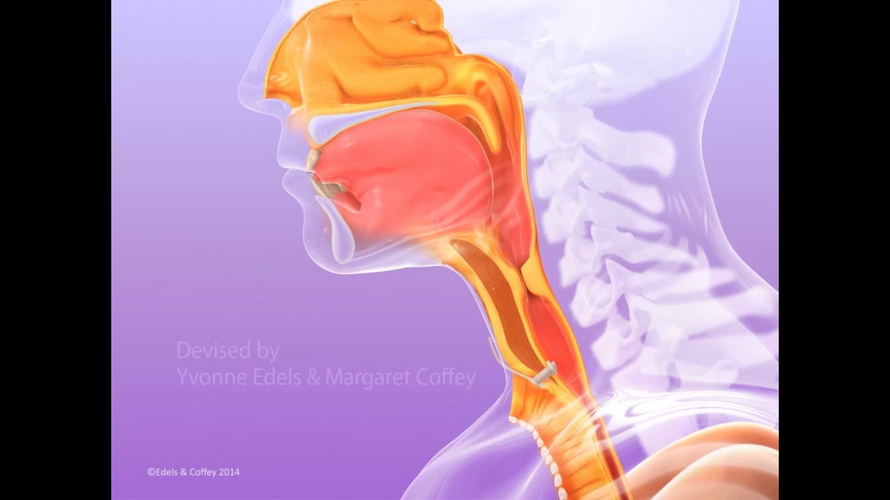 A unique Elearning module on Laryngectomy Surgical Voice Restoration for Head & Neck Cancer created by Yvonne Edels and Margaret Coffey with Imperial College, London and Imperial College Healthcare NHS Trust.