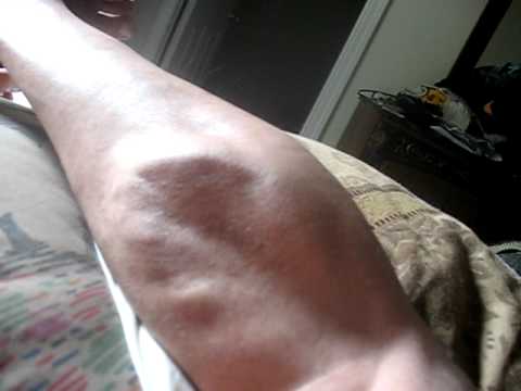 how to help leg cramps