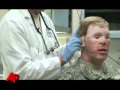 Video Essay: Cutting Edge in Face Prosthetics