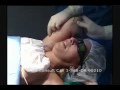 Smart lipo the ultimate non-surgical liposuction.mpeg