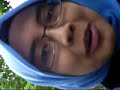 After Gen.Surgery Exam