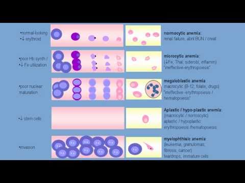 how to treat rbc morphology
