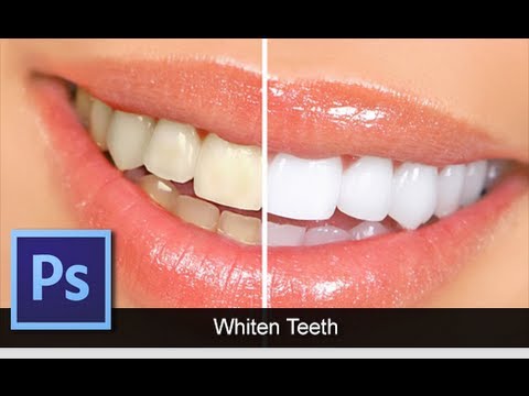 how to whiten teeth in adobe photoshop