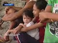 Sakit sa balat