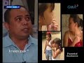 Sakit sa balat