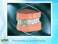 UMO - Cómo prevenir la caries dental
