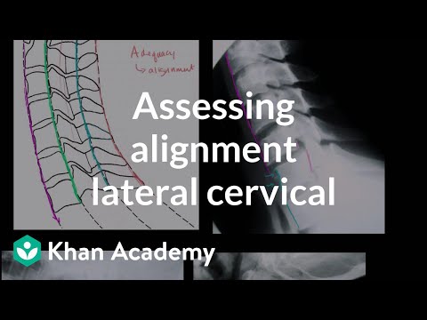 how to assess an x ray