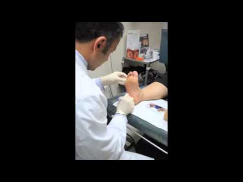how to treat sweaty feet