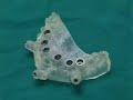 Implant Guided Surgery