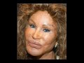 Jocelyn Wildenstein plastic surgery nightmare reversal Jocelyn Wildenstein plastic surgery nightmare reversal