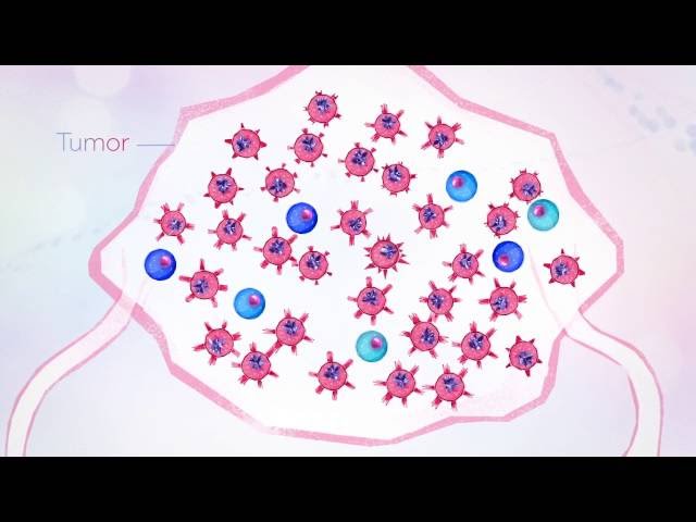 What is cancer?