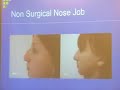 Non Surgical Cosmetic Procedures UCLA Dr. Alexander Rivkin Non Surgical Cosmetic Procedures UCLA Dr. Alexander Rivkin